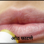 oth fatne oth ulnae mhnje kay chapped lips chapped lips in marathi gharguti ramban upcahr for chapped lips in marathi treatment of crack lips in marahti gharguti upchar for crack lips