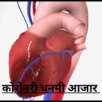 कोरोनरी धामणी आजार कोरोनरी धमनी आजार coronary artery disease coronary disease cad