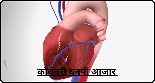 कोरोनरी धामणी आजार कोरोनरी धमनी आजार coronary artery disease coronary disease cad