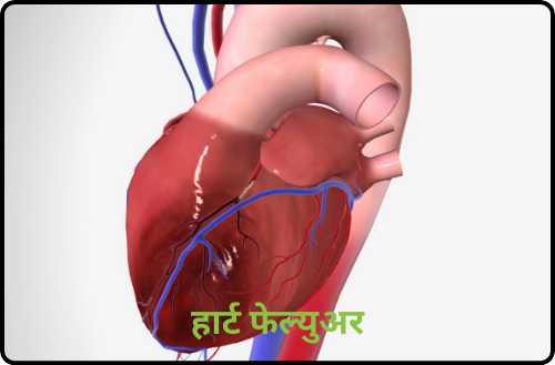 heart fail mhnje kay heart fail heart failure means heart failure symptoms heart failure causes in marathi treatment of heart failure in marathi